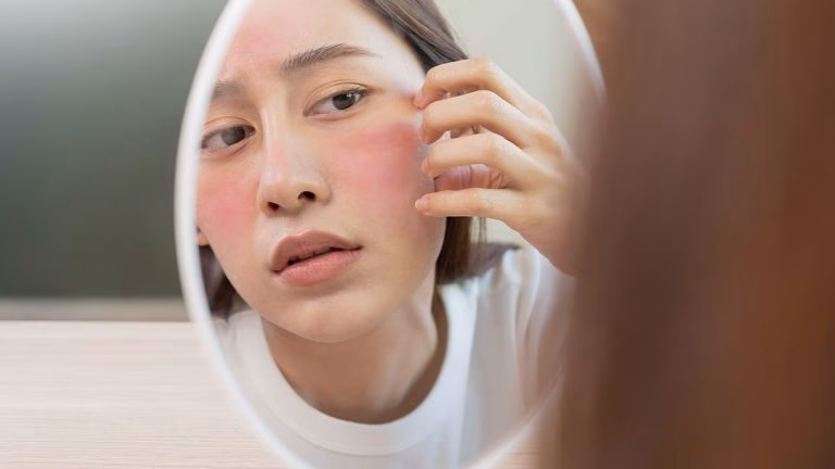 jenis-jenis gatal di wajah