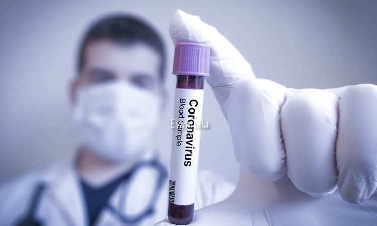Eva Mulia - Klinik Evamulia - Virus Corona - Perawatan Wajah - Virus corona adalah atau severe acute respiratory syndrome coronavirus 2 (SARS-CoV-2) adalah virus yang menyerang sistem pernapasan. Penyakit ini karena infeksi virus ini disebut COVID-19. Virus Corona bisa menyebabkan gangguan pada sistem pernapasan, pneumonia akut hingga kematian.