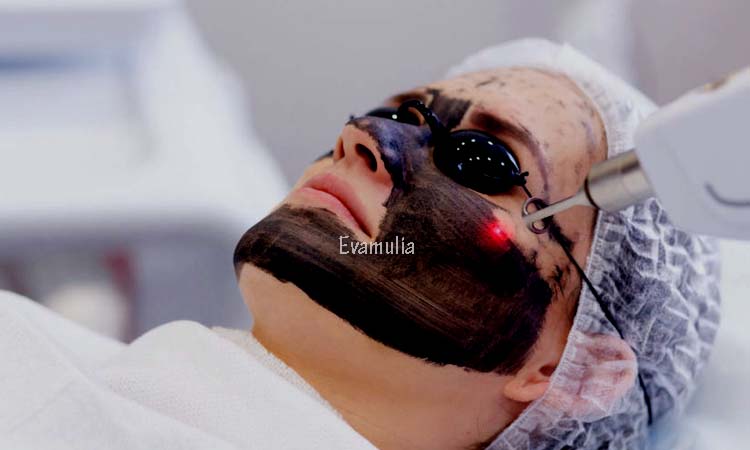 Evamulia - Perawatan Wajah - Fakta Perawatan Laser Untuk Menghilangkan Bekas Jerawat - Seperti yang kita ketahui, bahwa masalah umum pada kulit wajah adalah jerawat dan bekas jerawat. Jika bertanya mengenai cara terampuh untuk menghilangkan bekas jerawat, perawatan laser adalah jawaban yang paling banyak ditemukan.