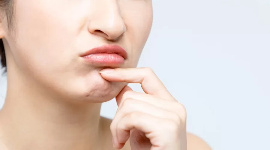 Kandungan Skincare yang Tepat