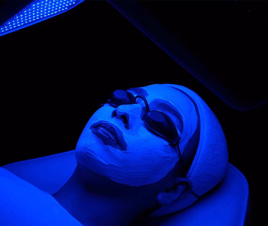 Advance Acne Peeling Treatment - Eva Mulia Clinic