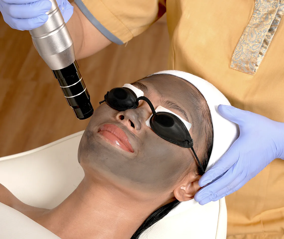 carbon laser facial, black doll laser treatment, pico laser before after, skin rejuvenation laser, carbon peel facial, glowing skin laser treatment, non invasive facial treatment, laser facial clinic, carbon mask laser therapy, carbon laser treatment procedure