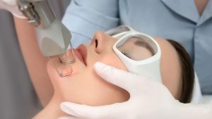 Manfaat Laser CO2 Fractional