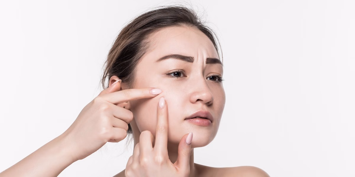cara menghilangkan putih putih di wajah,  Bahan anti-aging yang kamu gunakan bisa jadi tidak efektif. Cari tahu kenapa dan bagaimana memilih yang benar-benar bekerja untuk kulitmu di artikel ini.