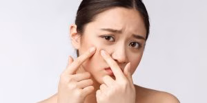 Apa Itu Panthenol dan Kenapa Bisa Bermanfaat Buat Jerawat?