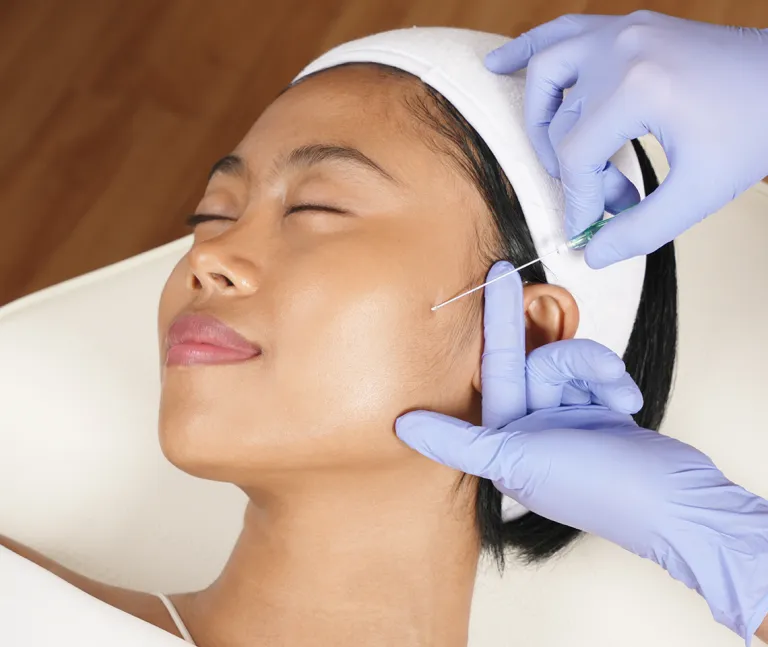 Beda Thread Lift, Filler, dan Botox yang Sering Tertukar