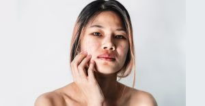 Wajah Kusam dan Susah Cerah? Cara Mengatasi Kulit Kusam yang Jarang Dibahas tapi Penting Banget!